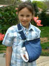 Rachel's broken bone.JPG (50455 bytes)
